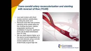 Defining High risk patients for TCAR; How to avoid complications.
