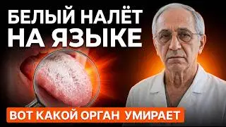БЕЛЫЙ НАЛЁТ НА ЯЗЫКЕ — ЭТО НЕ БАКТЕРИИ. ВОТ КАКОЙ ОРГАН УМИРАЕТ!
