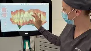 escaneado