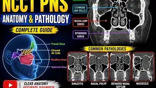 NCCT PNS 