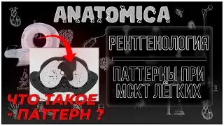 Что такое МАТОВОЕ СТЕКЛО и АЛЬВЕОЛЯРНАЯ КОНСОЛИДАЦИЯ легких при КТ ? / Рентгенология