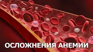 Осложнения анемии
