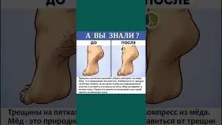 Трещины на пятках поможет убрать компресс из мёда #трещинынапятках #пятки #здоровье  #полезнознать