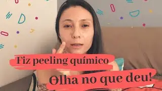 Como acabar com as manchas da pele - PEELING QUÍMICO PARTE 1