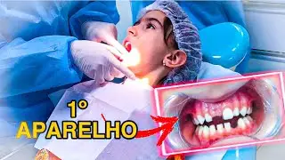 BELINHA COLOCOU APARELHO NOS DENTES PELA PRIMEIRA VEZ