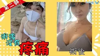 媽媽大改造:自然無痛的隆乳 | 在韓國整形 第二部