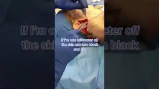 Forbidden Images of a Facelift 