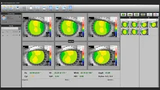 Topografo de Corne RM -  Equipamento para análise e diagnóstico da córnea