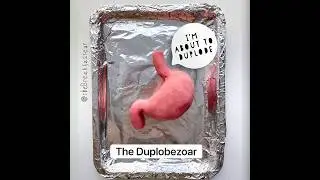 Playdough Surgery - Bezoar Removal