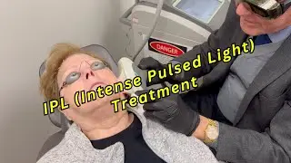 Intense Pulsed Light Treatment