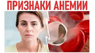 СИМПТОМЫ АНЕМИИ | Как распознать симптомы?