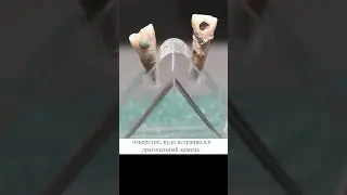 Камни вставляли в зубы 😲😲😲