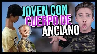 11 ADOLESCENTES QUE NO CREERÁS QUE EXISTEN - NACIÓ CON 232 DIENTES - CHACHATI