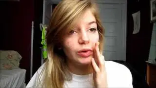 Accutane Diary: Day 51 (Week 8, Month 2)