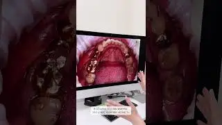 КЕЙС ВРАЧА ПОПОВОЙ ИРИНЫ ВЯЧЕСЛАВОВНЫ