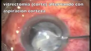 E3 video abundante corteza.m4v