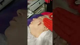 16.11  Нити (фрагмент).