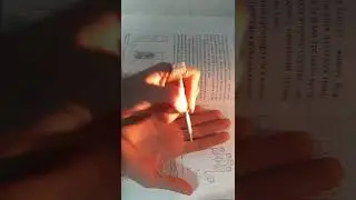 Су джок терапия при боли внизу живота. 