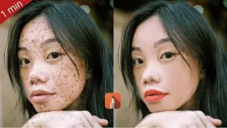 Remove Spot in 1 min 🔥 with Your Mobile Face smooth and soft - QK Pictures