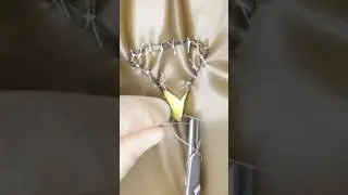 V-to-Y Plasty 