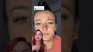 WASH YOUR FACE, YOUR ACNE WILL PASS❗️😱