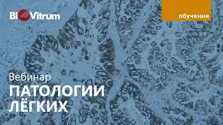 Вебинар 