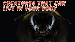 10 fascinating creatures that can live in your body,#MedicalResearch#Parasitology