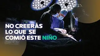 Las cosas MÁS EXTRAÑAS encontradas dentro de personas
