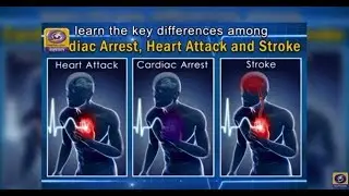 Arogya Bharat | Healthy Heart | 24th February 2020