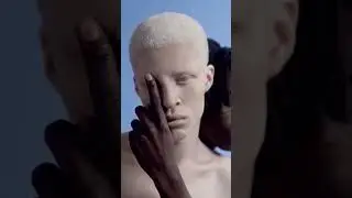 13 Giugno: Giornata Internazionale dell'ALBINISMO #albinism #albinismo #notghosts 🧑‍🦳🧝