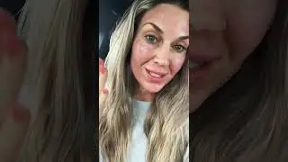 Influencer Visits Dr  Erin Ducharme for Luvo Darwin RFMN