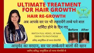 Dermaroller for Hair Loss: How to Use Derma Roller for Hair Growth? |  Hair Care & Loss (Hindi) |