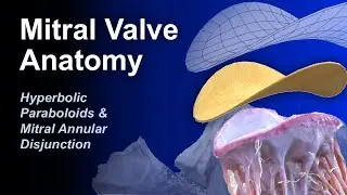 Mitral Valve Anatomy, Annular Disjunction & Hyperbolic Paraboloids