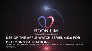 How to use the Apple Watch to detect ventricular ectopic beats