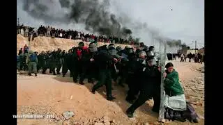 Pulitzer Ödülü Almış Fotoğraflar ve Hikayeleri - 2