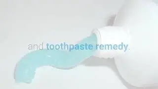Pearly Papules Removal Easy and Quickly | Remove PPP In 3 DAYS GUARANTEED