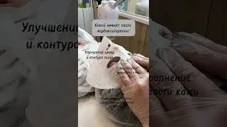 Карбокситерапия муолажаси #tashkent #uzbekistan ##интересно #карбокситерапия #istanbul #turkey