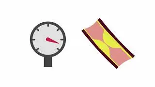 Identifying common hemodialysis access complications