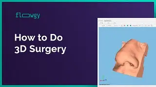 How to do 3D Surgery with Flowgy | Flowgy Academy