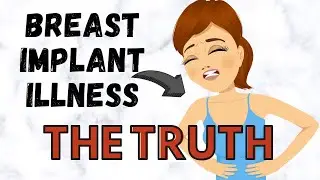 BREAST IMPLANT ILLNESS - The Truth (Breast Implant Removal)
