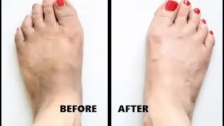 Lighten & Brighten Dark Tanned Feet in 10 Minutes Only | Pedicure to Whiten Dark Feet