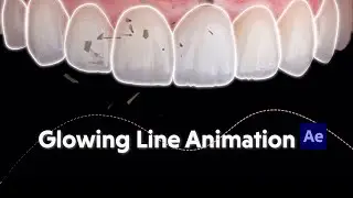 Dental motion graphics - glowing line animation around teeth