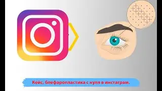 Кейс реклама блефаропластика с нуля в инстаграм. Стратегия продвижения клиники красоты.