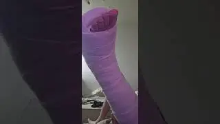 hip spica cast