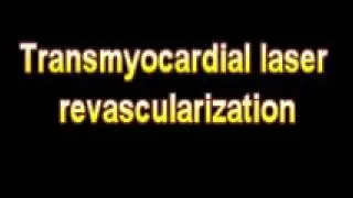 What Is The Definition Of Transmyocardial laser revascularization