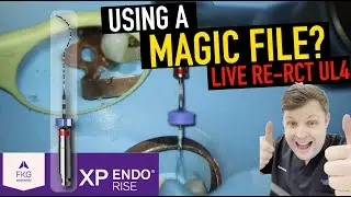 RE-RCT UL4 | XP ENDO FINISHER FILE REVIEW | 4k Resolution.
