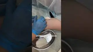 Контрацептив с эффективностью выше 99,9% на 3 года🔝