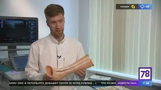 Чем заменить гипсовую повязку при переломах конечностей?