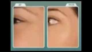 Глаз Губы Stem cell therapy Крем