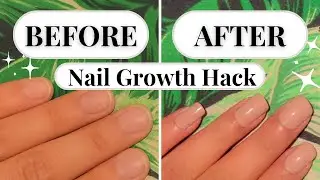 How to Grow Your Nails FAST! Works 1000%